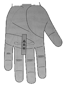 Лечение менструальной боли