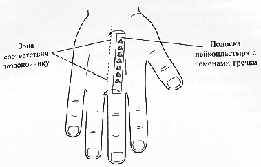 Лечение пояснично-крестового отдела позвоночника в стандартной системе соотвествия кисти
